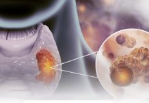 ‘क्यान्सरबाट हरेक वर्ष दश लाख ज्यान जान्छ’