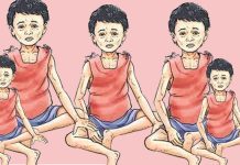 पोषण लेखाजोखा : तीन सय ४७ बालबालिका कुपोषित
